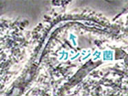 カンジタ菌