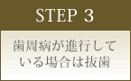 STEP 3 歯周病が進行している場合は抜歯